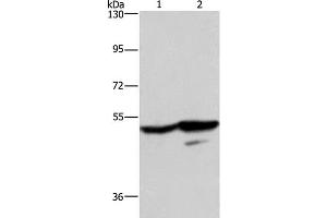 Western Blot analysis of A431 and K562 cell using GPR39 Polyclonal Antibody at dilution of 1:200 (GPR39 antibody)
