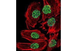 Fluorescent confocal image of A549 cell stained with FOSL2 Antibody . (FOSL2 antibody  (C-Term))