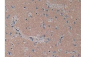 Detection of STAM1 in Human Brain Tissue using Polyclonal Antibody to Signal Transducing Adaptor Molecule 1 (STAM1)