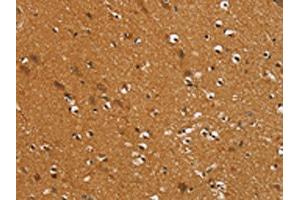 The image on the left is immunohistochemistry of paraffin-embedded Human brain tissue using ABIN7192401(SLC16A3 Antibody) at dilution 1/30, on the right is treated with synthetic peptide. (SLC16A3 antibody)