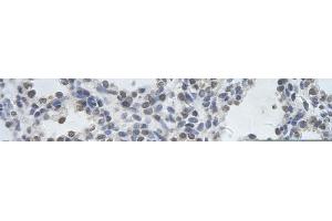 Rabbit Anti-DDX17 Antibody       Paraffin Embedded Tissue:  Human alveolar cell   Cellular Data:  Epithelial cells of renal tubule  Antibody Concentration:   4. (DDX17 antibody  (N-Term))