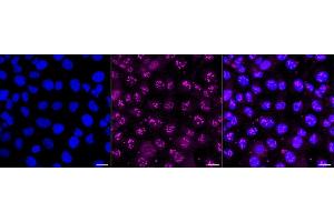 Immunocytochemical staining of HT- cells with Proteasome activator subunit 1 antibody (ABIN7799957), 1:1,000). (Recombinant LACBIDRAFT 301065 antibody  (Subunit 1))