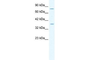 WB Suggested Anti-MCM4 Antibody Titration:  1. (MCM4 antibody  (Middle Region))