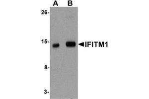 Western blot analysis of IFITM1 in 3T3 cell lysate with IFITM1 antibody at (A) 1 and (B) 2 μg/ml. (IFITM1 antibody  (Center))