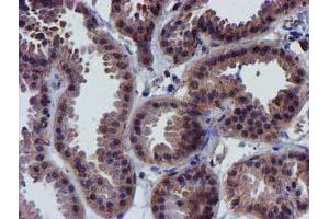 Immunohistochemical staining of paraffin-embedded Human breast tissue using anti-CHCHD5 mouse monoclonal antibody. (CHCHD5 antibody  (AA 1-110))