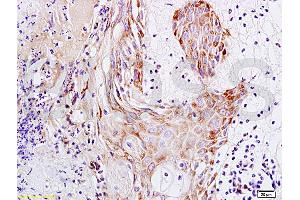 Formalin-fixed and paraffin embedded rat skin tissue labeled with Anti-S100A7 Polyclonal Antibody, Unconjugated (ABIN718301) at 1:200 followed by conjugation to the secondary antibody and DAB staining (S100A7A antibody  (AA 41-108))