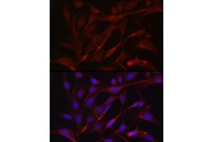 Immunofluorescence (IF) image for anti-Metalloproteinase Inhibitor 2 (TIMP2) (AA 100-200) antibody (ABIN1513608)