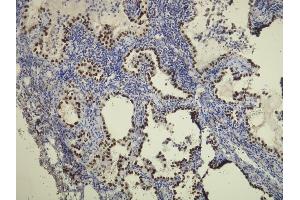 Immunohistochemistry (IHC) image for anti-Transcription Termination Factor, RNA Polymerase I (TTF1) (AA 97-110), (N-Term) antibody (ABIN870521)