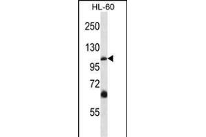 TRPC5 Antibody (N-term) (ABIN657691 and ABIN2846682) western blot analysis in HL-60 cell line lysates (35 μg/lane).