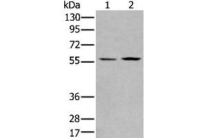 Western Blotting (WB) image for anti-PiggyBac Transposable Element Derived 2 (PGBD2) antibody (ABIN2422351)