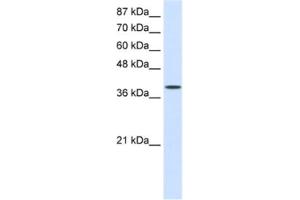 Western Blotting (WB) image for anti-Eukaryotic Translation Initiation Factor 4 gamma 2 (EIF4G2) antibody (ABIN2462107)