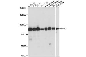 Western blot analysis of extracts of various cell lines, using G2E3 antibody.