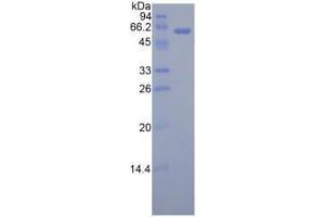 Image no. 1 for Adiponectin Receptor 1 (ADIPOR1) (AA 1-136) (Active) protein (His tag,GST tag) (ABIN5665758) (Adiponectin Receptor 1 Protein (ADIPOR1) (AA 1-136) (His tag,GST tag))