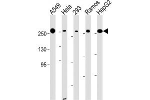 All lanes : Anti-FASN Antibody (Center) at 1:500-1:2000 dilution Lane 1: A549 whole cell lysate Lane 2: Hela whole cell lysate Lane 3: 293 whole cell lysate Lane 4: Ramos whole cell lysate Lane 5: HepG2 whole cell lysate Lysates/proteins at 20 μg per lane.