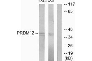 Western Blotting (WB) image for anti-PR Domain Containing 12 (PRDM12) (Internal Region) antibody (ABIN1849975) (PRDM12 antibody  (Internal Region))