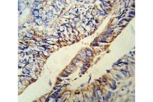 Immunohistochemistry (IHC) image for anti-Proprotein Convertase Subtilisin/kexin Type 9 (PCSK9) (AA 479-508) antibody (ABIN3032342)