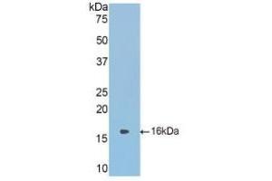 Detection of Recombinant CBG, Mouse using Polyclonal Antibody to Corticosteroid Binding Globulin (CBG) (SERPINA6 antibody  (AA 268-391))