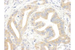 anti-Inositol 1,4,5-Trisphosphate Receptor, Type 3 (ITPR3) (AA 625-675) antibody