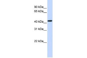 WB Suggested Anti-OPRK1 Antibody Titration:  0.