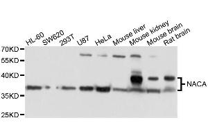 Western blot analysis of extracts of various cell lines, using NACA antibody. (NACA antibody  (AA 1-215))