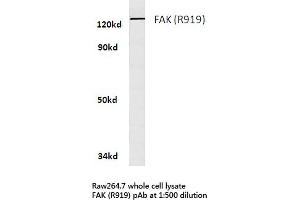 Western blot (WB) analyzes of FAK antibody in extracts from raw264. (FAK antibody)