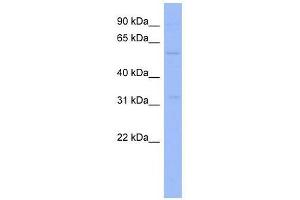 ZNF266 antibody used at 0. (ZNF266 antibody  (Middle Region))