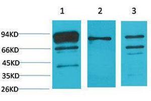 Western Blotting (WB) image for anti-Calnexin (CANX) antibody (ABIN3181566) (Calnexin antibody)
