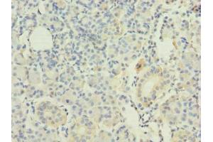 Immunohistochemistry of paraffin-embedded human pancreatic tissue using ABIN7167395 at dilution of 1:100 (RAP1A antibody  (AA 1-181))