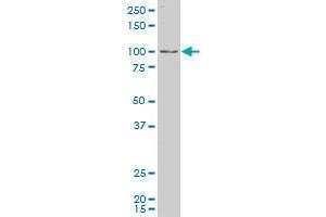 SLC26A9 polyclonal antibody (A01), Lot # 060717JCS1. (Slc26a9 antibody  (AA 496-605))