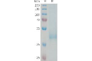 Killer Cell Immunoglobulin-Like Receptor, three Domains, Long Cytoplasmic Tail, 3 (KIR3DL3) (AA 26-322) protein (His tag)