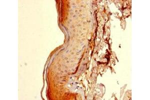 Immunohistochemistry of paraffin-embedded human skin tissue using ABIN7172166 at dilution of 1:100 (CCDC59 antibody  (AA 1-241))