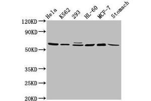 Western Blot Positive WB detected in: Hela whole cell lysate, K562 whole cell lysate, 293 whole cell lysate, HL60 whole cell lysate, MCF-7 whole cell lysate, Rat stomach tissue All lanes: GATAD2A antibody at 2. (GATAD2A antibody  (AA 170-241))