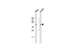 Western Blot at 1:2000 dilution Lane 1: Hela whole cell lysate Lane 2: Jurkat whole cell lysate Lysates/proteins at 20 ug per lane. (FBXO32 antibody  (AA 17-49))