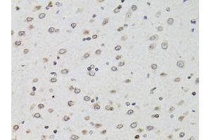 Immunohistochemistry of paraffin-embedded mouse brain using TMPO Antibody (ABIN5971365) at dilution of 1/100 (40x lens). (Thymopoietin antibody)