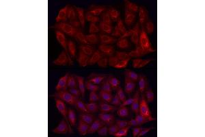 Immunofluorescence analysis of U2OS cells using MMP7 Rabbit pAb (ABIN3021102, ABIN3021103, ABIN3021104, ABIN1513214 and ABIN6213952) at dilution of 1:350 (40x lens). (MMP7 antibody  (AA 18-267))