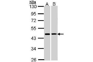WB Image HSD3B2 antibody [N3C3] detects HSD3B2 protein by Western blot analysis.