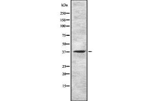 Western blot analysis GNRHR using HuvEc whole cell lysates (GNRHR antibody  (N-Term))