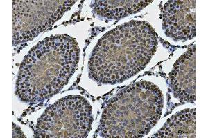 IHC analysis of MSY2/YBOX2/YBX2 using anti-MSY2/YBOX2/YBX2 antibody (ABIN7600636). (YBX2 antibody  (AA 211-364))