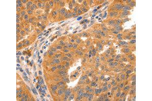 Immunohistochemistry (IHC) image for anti-Glutamate Receptor, Metabotropic 8 (GRM8) antibody (ABIN1872903) (GRM8 antibody)