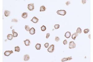 Immunocytochemistry (ICC) image for anti-Platelet Derived Growth Factor Receptor alpha (PDGFRA) (AA 24-525) antibody (ABIN7453341) (Recombinant PDGFRA antibody  (AA 24-525))