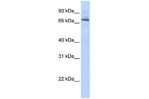 WB Suggested Anti-TRIM6 Antibody Titration:  0. (TRIM6 antibody  (Middle Region))