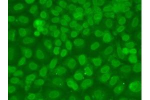 Immunofluorescence analysis of A549 cells using TARBP2 antibody.