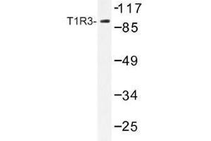 Image no. 1 for anti-Taste Receptor, Type 1, Member 3 (TAS1R3) antibody (ABIN317869) (TAS1R3 antibody)