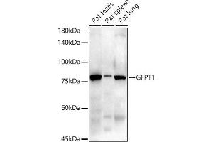 Western blot analysis of extracts of various cell lines, using GFPT1 antibody (ABIN7267430) at 1:1000 dilution. (GFPT1 antibody)
