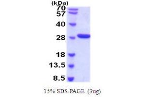 SDS-PAGE (SDS) image for Complement Factor D (CFD) (AA 21-253) protein (His tag) (ABIN5854249)