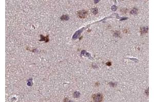 ABIN6267613 at 1/100 staining human brain tissue sections by IHC-P. (PKC zeta antibody  (pThr410))