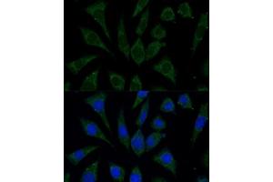 Immunofluorescence (IF) image for anti-Aldo-keto Reductase Family 1, Member C2 (AKR1C2) (AA 1-323) antibody (ABIN7265549)