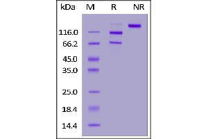 Human Complement C5, His Tag on  under reducing (R) and ing (NR) conditions. (C5 Protein (AA 19-1676) (His tag))