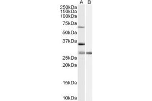 Image no. 1 for anti-Pre-mRNA Processing Factor 31 (PRPF31) (Internal Region) antibody (ABIN375228) (PRPF31 antibody  (Internal Region))