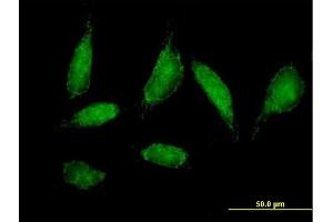 Immunofluorescence of purified MaxPab antibody to CHCHD3 on HeLa cell. (CHCHD3 antibody  (AA 1-227))